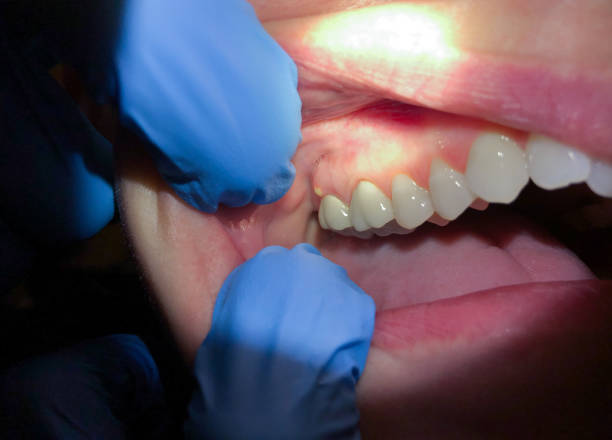 Best Mobile Emergency Dentist in Short Pump, VA
